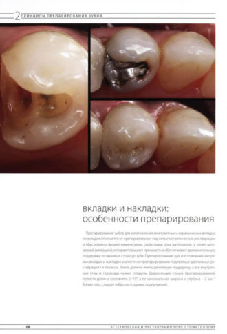 Скачать Эстетическая и реставрационная стоматология. Выбор материалов и методов — Дуглас Терри Вилли Геллер